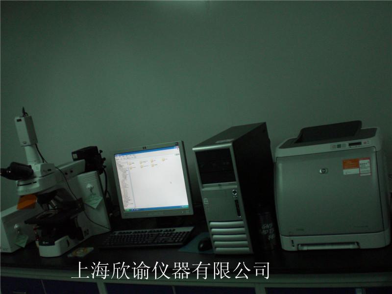 染色体分析系统（XY-RS-A2）、高配核型分析系统欣谕染色体分析系统，染色体图像分析系统，染色体核型分系统
